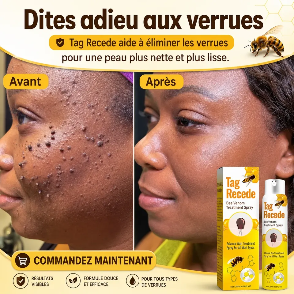Présentation avant et après de Tag Recede